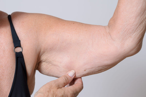 Is the Fear of Saggy Skin Keeping You from Losing Weight?
