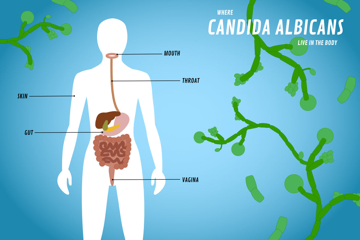 Candida 101: What is Candida Overgrowth? – Skinny Up!